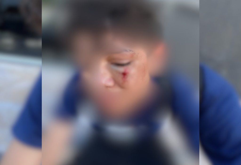 Família denuncia agressão a aluno após caso de bullying em escola no Tocantins